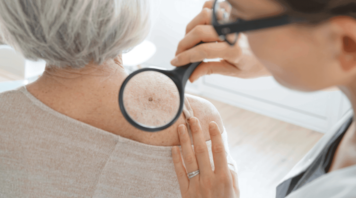Mohs surgery explained: What to expect and why it works
