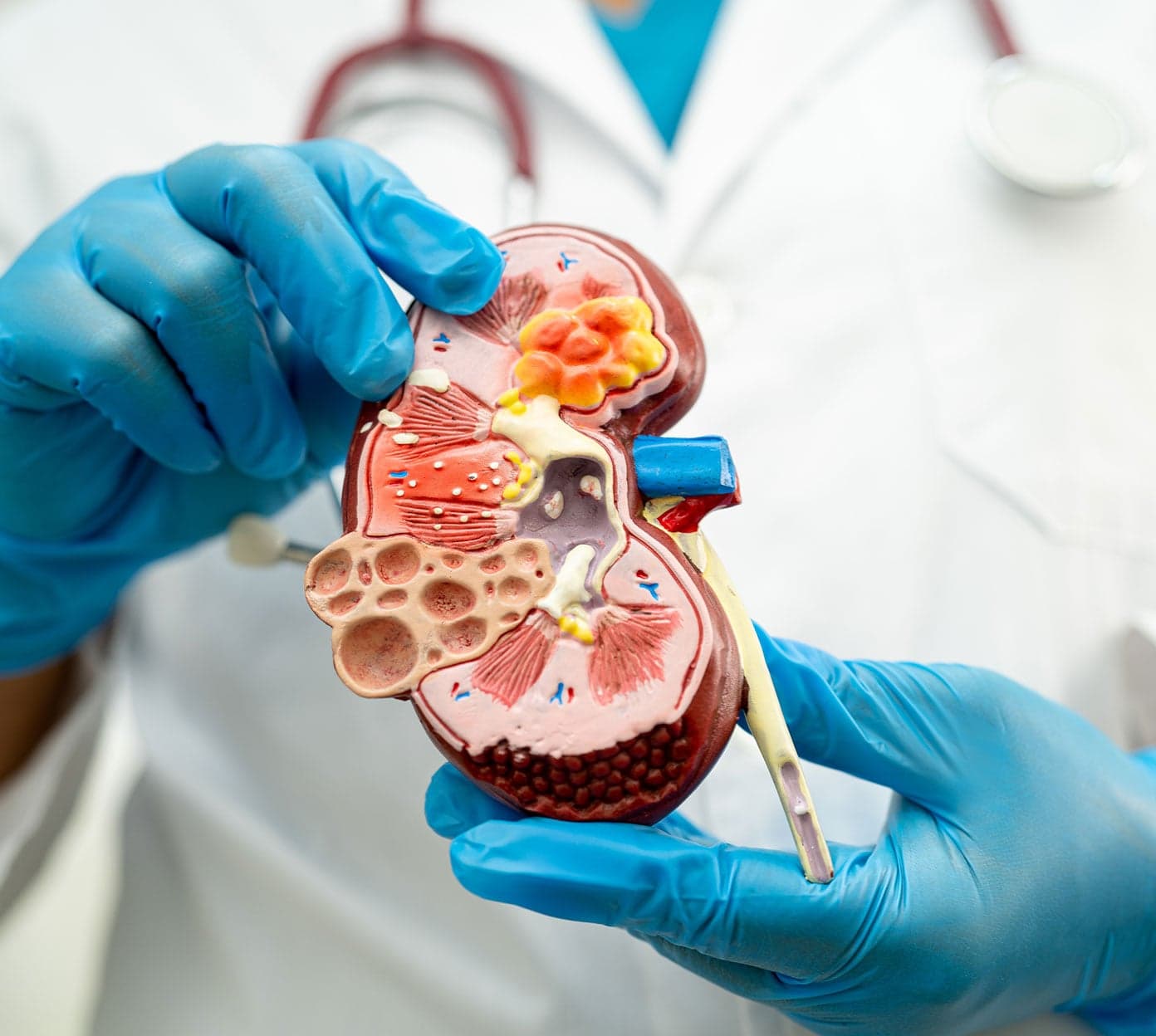 Nephrology-1392-x-1248