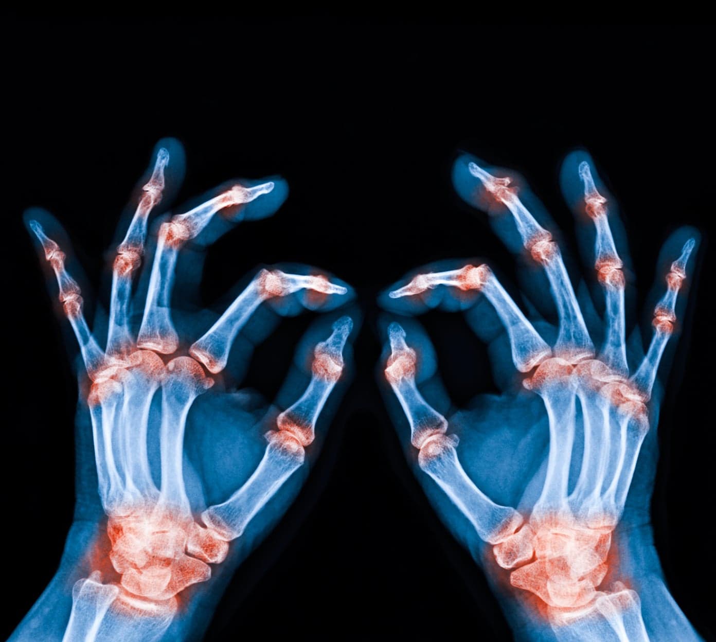 rheumatology
