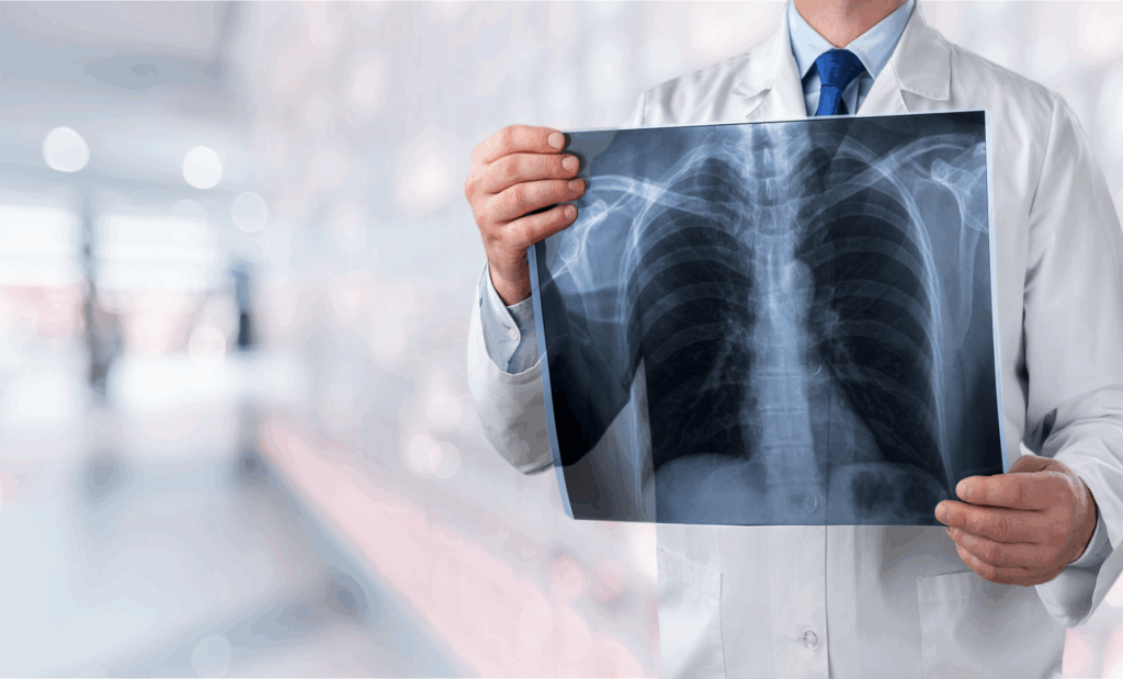 Doctor reading scan of lungs
